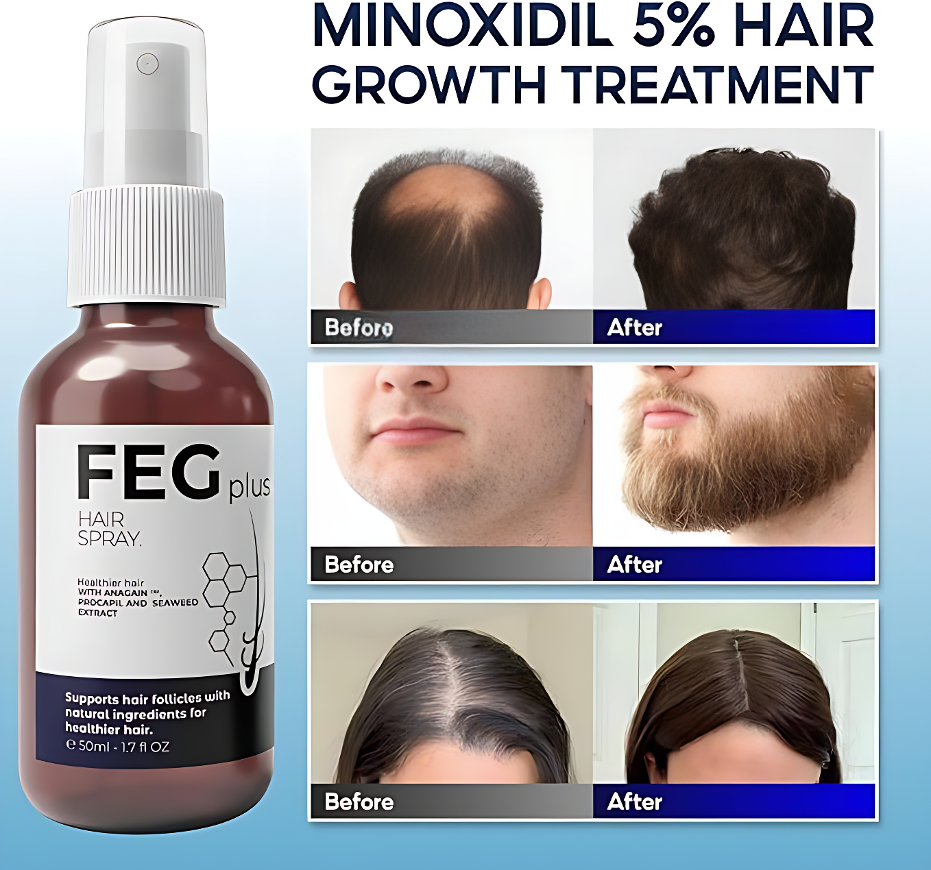 Hair Growth Spray PLUS